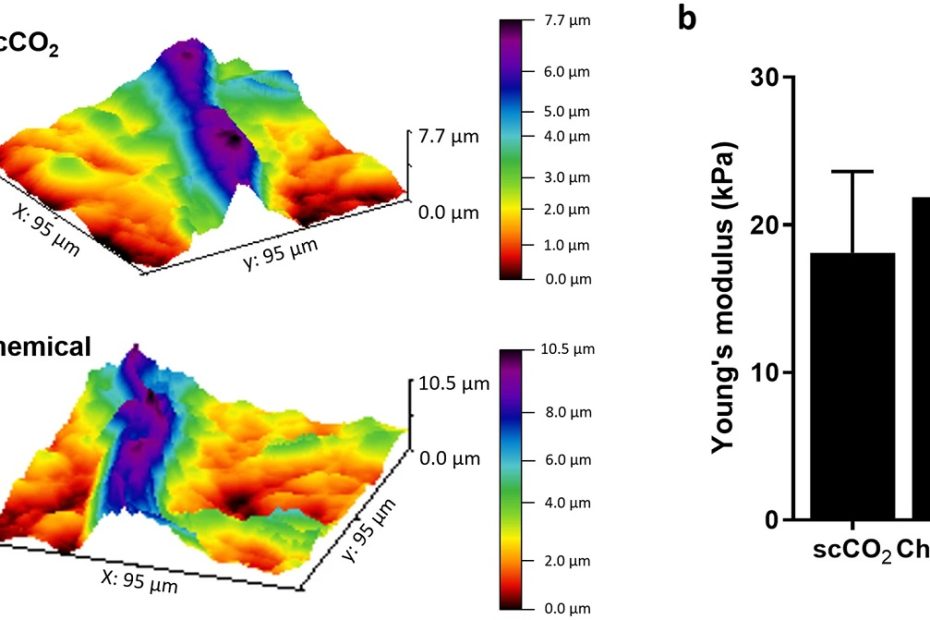 Figure 3 from “Supercritical carbon dioxide decellularization of plant material to generate 3D biocompatible scaffolds AFM imaging and spectrometry measurement” by Ashlee F. Harris et al.: They used AFM surface topography measurements to confirm that the structures such as plant vasculature were preserved after the scSO2 process and used AFM force curves to calculate the Young’s Modulus (YM) of the scCO2 decellularized scaffold. NANOSENSORS uniqprobe qp-BioAC AFM probes were used for the described AFM measurments. (a) Representative false colored three-dimensional surface mapping images and (b) Young’s modulus of scCO2 and chemically decellularized scaffolds (data as mean ± SEM; n = 5).