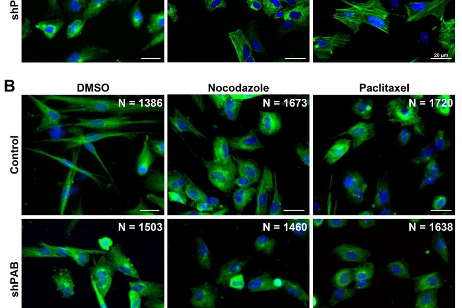 Figure 4 from “Cytoskeletal disorganization underlies PABPN1-mediated myogenic disability” by Cyriel Sebastiaan Olie et al. Disrupted cytoskeletal spatial organization in shPAB human muscle cell cultures. A Representative images of control and shPAB human muscle cell cultures, stained with antibodies to tubulin and actin, and the actin filaments were visualized with actin-GFP. B Tubulin staining in control and shPAB myoblast cell cultures after DMSO, 100 nM nocodazole or 25 nM paclitaxel treatment for 2 h. Scale bar is 25 µm. C Measurements of cell-mechanics properties in control and shPAB cells using the Brillouin Light Scattering Microscopy (Ci) or the Atomic Force Microscopy (Cii). Measurements were carried out in myoblasts; every dot represents the median from 1000 measurements in a cell. Cell stiffness is measured by GHz, and the young modulus reports the cell surface tension. Averages and standard deviations are from N = 15 cells. Statistical significance was calculated with the student’s t-test. NANOSENSORS uniqprobe qp-BioAC ( CB3 ) AFM probes were used in the quantitative imaging of cell-mechanics properties where a force curve is applied at each point.